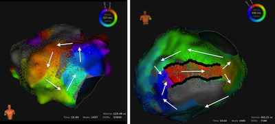 Cardiac mapping visualization